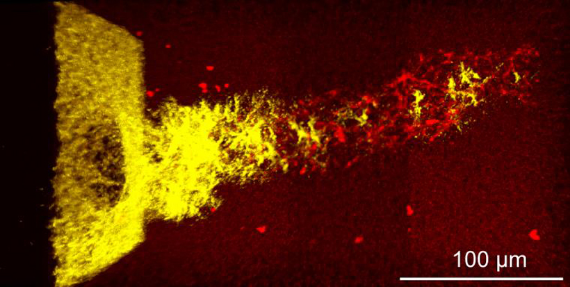 3d rendering of a clot network