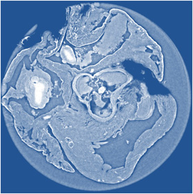 X-ray Tomography with Propagation-Based Imaging