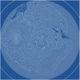 Absorption Contrast X-ray Imaging