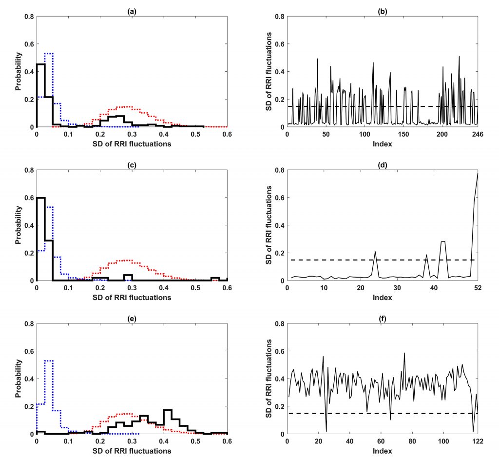 Bimodal distribution of cardiac states and cardiac state flickering before the onset of atrial fibrillation. CREDIT: Yew Wai Liew