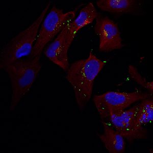 Brain immune cells, called microglia, play a critical role in protein clearance and can be a therapy target for neurodegenerative diseases. CREDIT: Nanxia Zhao