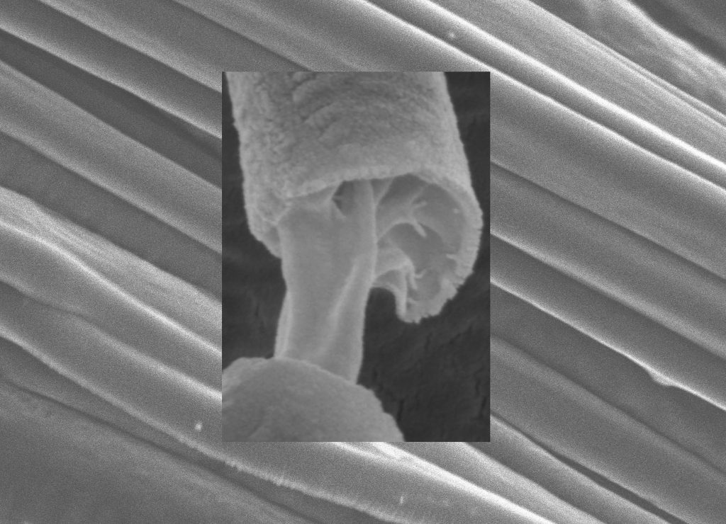 Aligned core-sheath fiber arrays mass-produced by pressurized gyration invented at UCL Mechanical Engineering with the core and sheath of the fibers clearly distinguishable by electron microscopy CREDIT: Sunthar Mahalingam