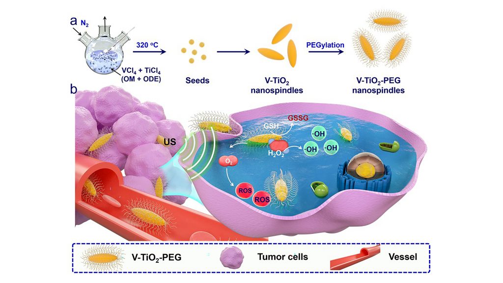 V-TiO2 nanospindles encased in polyethylene glycol (PEG) and used in combination with ultrasound waves can kill cancer cells CREDIT: Liang Cheng