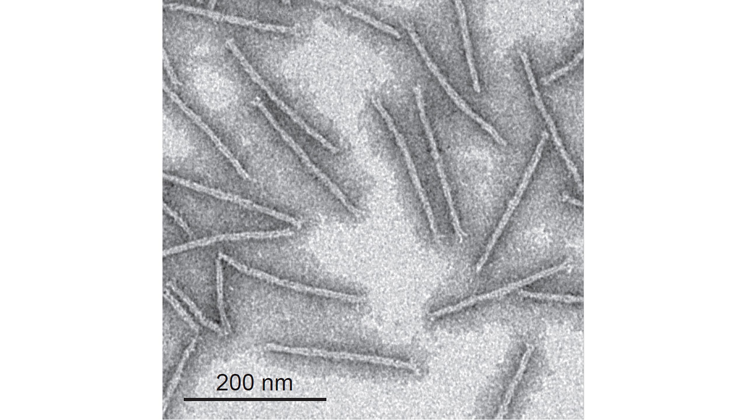 electron microscope images of dna