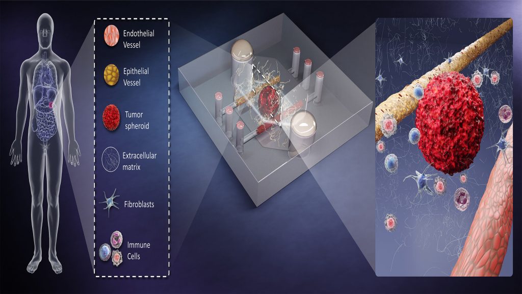 The potential of BMOMs for precision medicine CREDIT: Terry Juang