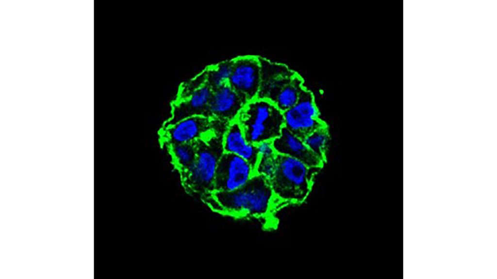 This micrograph shows breast cancer cells forming a tumor spheroid when grown under 3D culture conditions. CREDIT: Joanna Lee