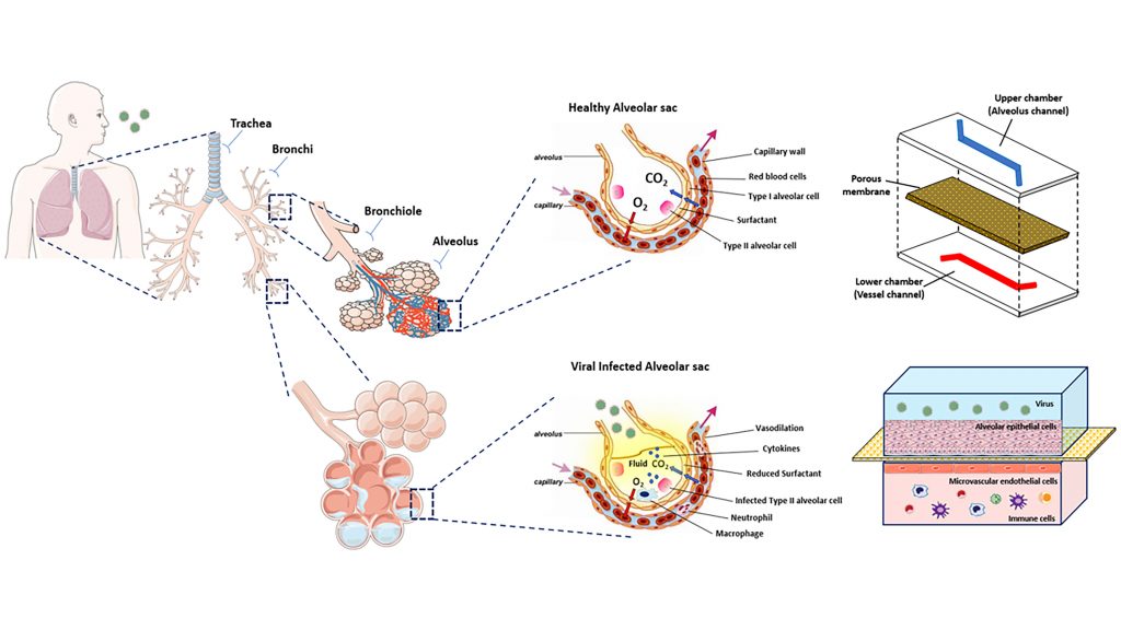 Simplified schematic model of the human lung with healthy and virus-infected alveolar sacs along with a viral infection on a lung alveolus platform. CREDIT: Yildiz-Ozturk