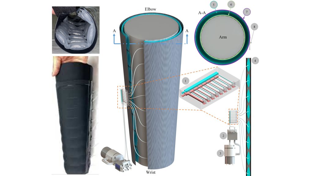 Images of the lymphedema sleeve (left) and a diagram of its components (right). The microfluidic chip sequentially inflates and deflates balloons, creating pressure and pushing fluid through the arm. CREDIT: Carolyn Ren