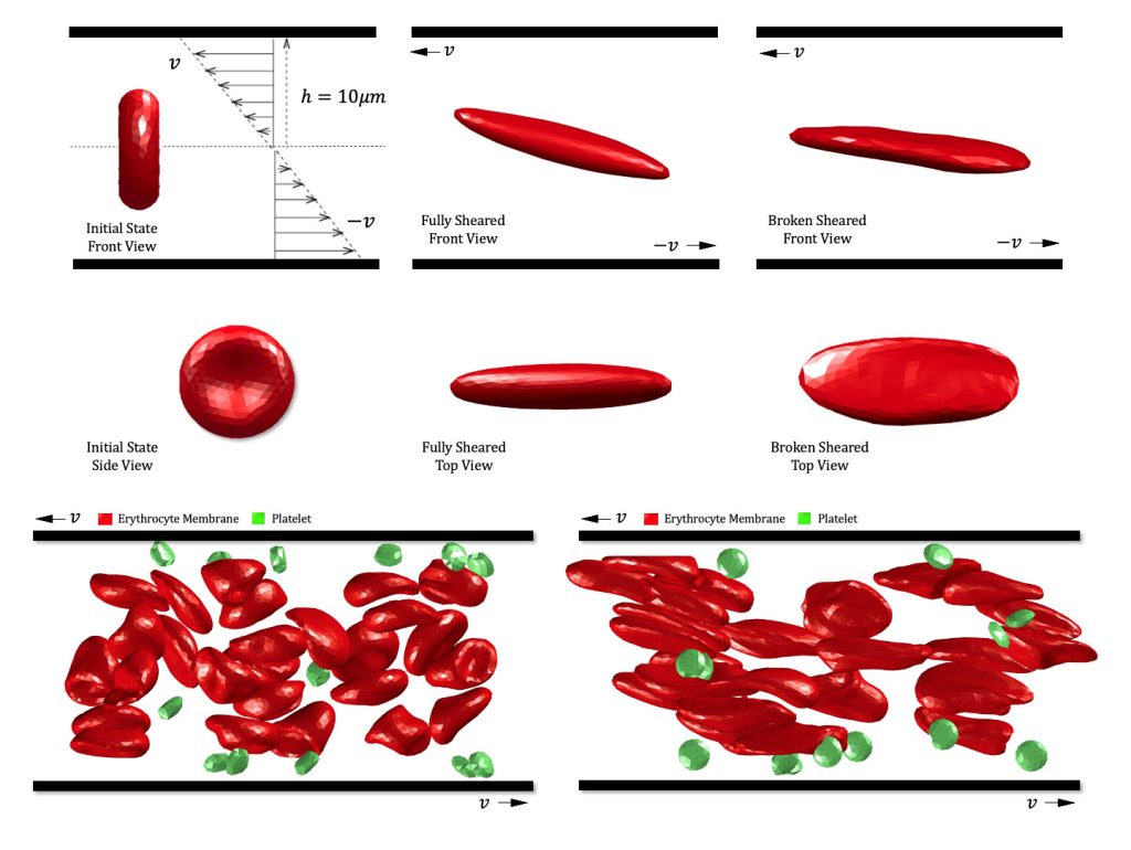 Above: A schematic diagram of shear flow. Below: A transport dissipation particle dynamics method was developed to simulate shear damage of red blood cells in real blood. CREDIT: Zhike Xu, Chenyang Wang, Sen Xue, Feng He, Pengfei Hao, and Xiwen Zhang