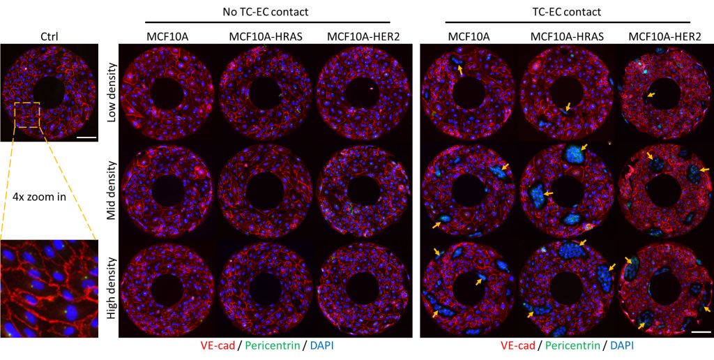 Immunofluorescence images showing the effects of contactless paracrine signaling interactions (left) or physical contact (right) in micropatterned endothelial cells and tumor cells. Credit: Jie Fan