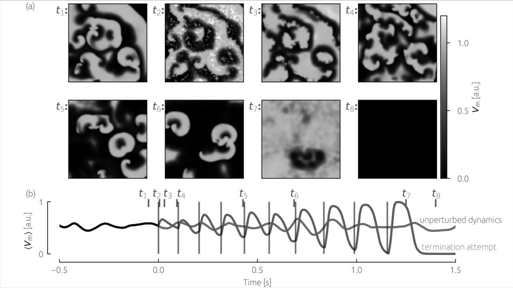 Exemplary successful termination attempt using the deceleration protocol, showing (a) the electrical wave dynamics defibrillation and (b) corresponding (pseudo)electrocardiogram. The pulses of the deceleration pulse sequence are marked as gray vertical lines. Credit: Thomas Lilienkamp