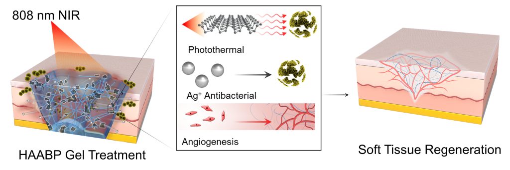 A black phosphorus-enhanced antibacterial injectable hydrogel was developed. In vitro, it achieved a synergetic antibacterial effect. In vivo, it was proved efficiently antibacterial with accompanied weaken inflammation expression and enhanced collagen deposition and angiogenesis, thus accelerating the healing process. Credit: Zhengwei Cai