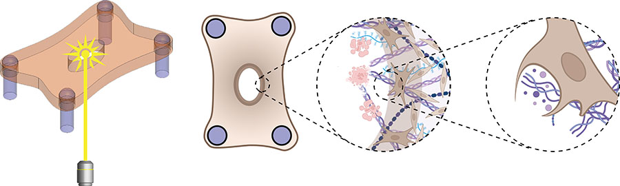 Dermal microtissues are ablated using a pulsed laser. Damaged extracellular matrix is cleared by dermal fibroblasts in the vicinity of the wound edge through phagocytosis. Created with BioRender.com. Credit: Jeroen Eyckmans and Anish Vasan