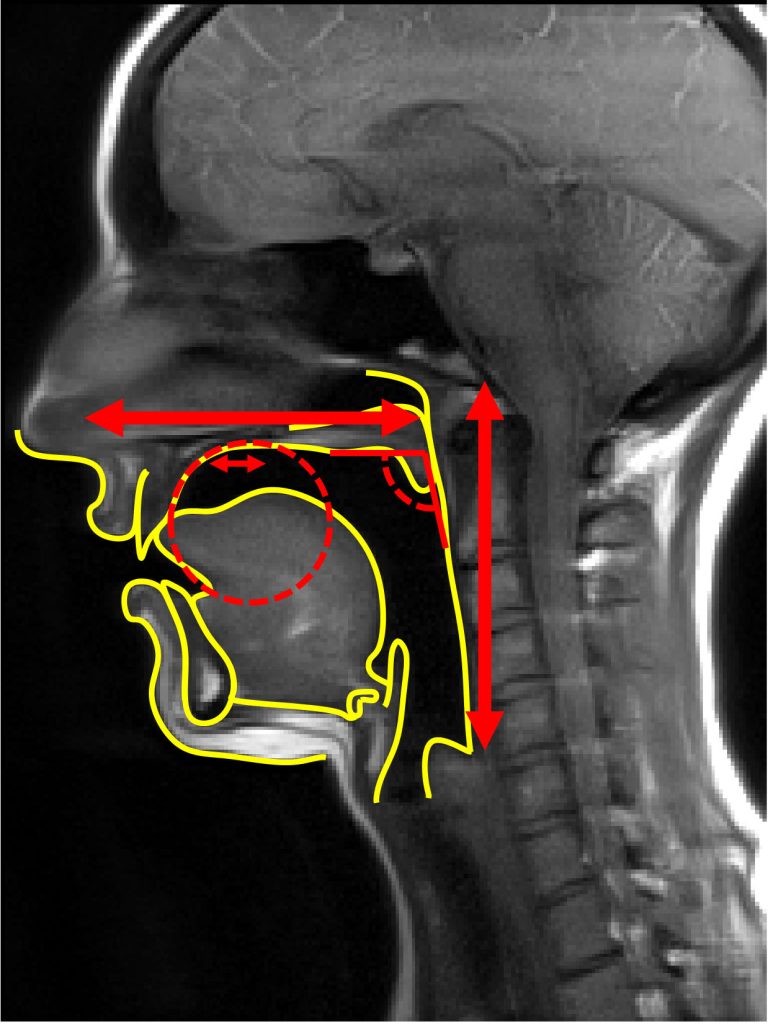 Main anatomical shape factors of the vocal tract. Credit: Antoine Serrurier