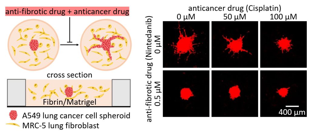 A 3D co-culture system mimics the tumor microenvironment for studying the impact of drug combinations. An anti-fibrotic drug, nintedanib, could improve the effect of an anti-cancer drug, cisplatin, to reduce tumor growth and invasion. Credit: Huei-Jyuan Pan