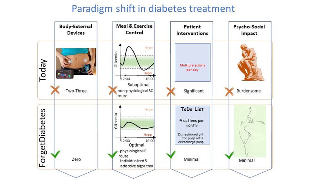 Advancements in automated insulin delivery technology, particularly elimination of the need for interactions with insulin delivery devices to manually enter estimates of carbohydrates in meals consumed, are significantly reducing the burden of disease management for patients with diabetes. Credit: Claudio Cobelli