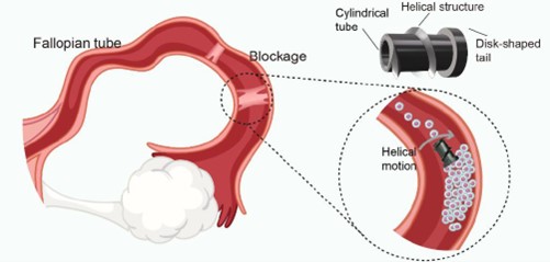 Magnetic robotic microscrew for oviduct recanalization. The magnetic microrobot clears the blockage based on mechanical motion under the rotating magnetic field. Credit: Liu et al.