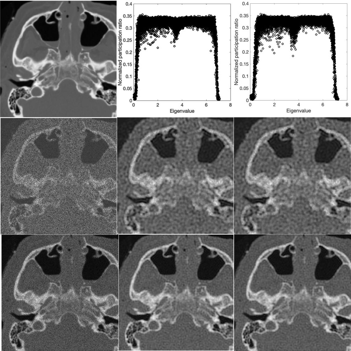 次のレベルのピクセル粒子の類推を使用した医療画像の明確化