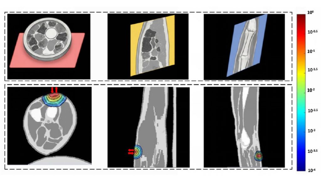 Near infrared optical measurements combined with a temperature-aware algorithm create an at-home skin hydration monitoring system that fills key gaps in skin care management. Credit: Yisong Xue et al.