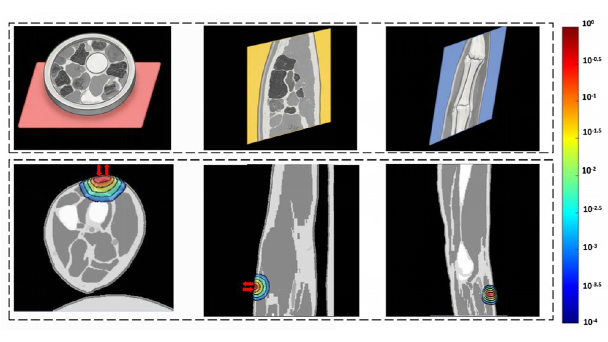 Home Skin Care Improved by Data From Infrared Hydration Measurement System